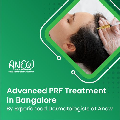 Prf treatment in Bangalore ​